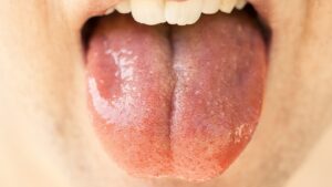 tongue, organ, mouth