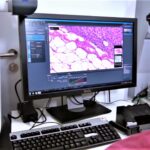 Quartalsergebnis BiNTech